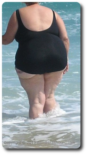 Image of Overweight